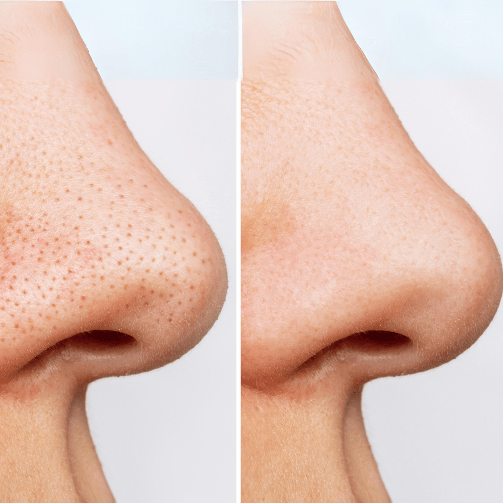 Anua Heartleaf Pore Control Cleansing Oil